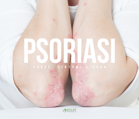 Psoriasi della pelle: cause, sintomi e cure efficaci per il trattamento