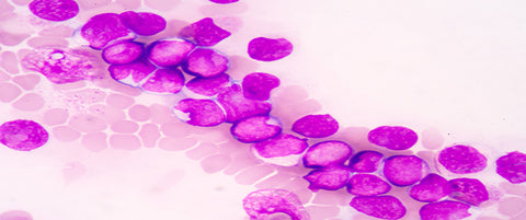 AHCC® supporta il sistema immunitario contro la Leucemia mieloide acuta